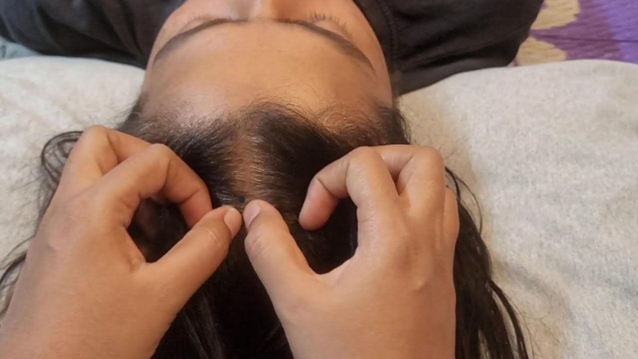 2026 Scalp Check ASMR: *INSTANT* TINGLES & Sleep! (Extreme Close-Up)