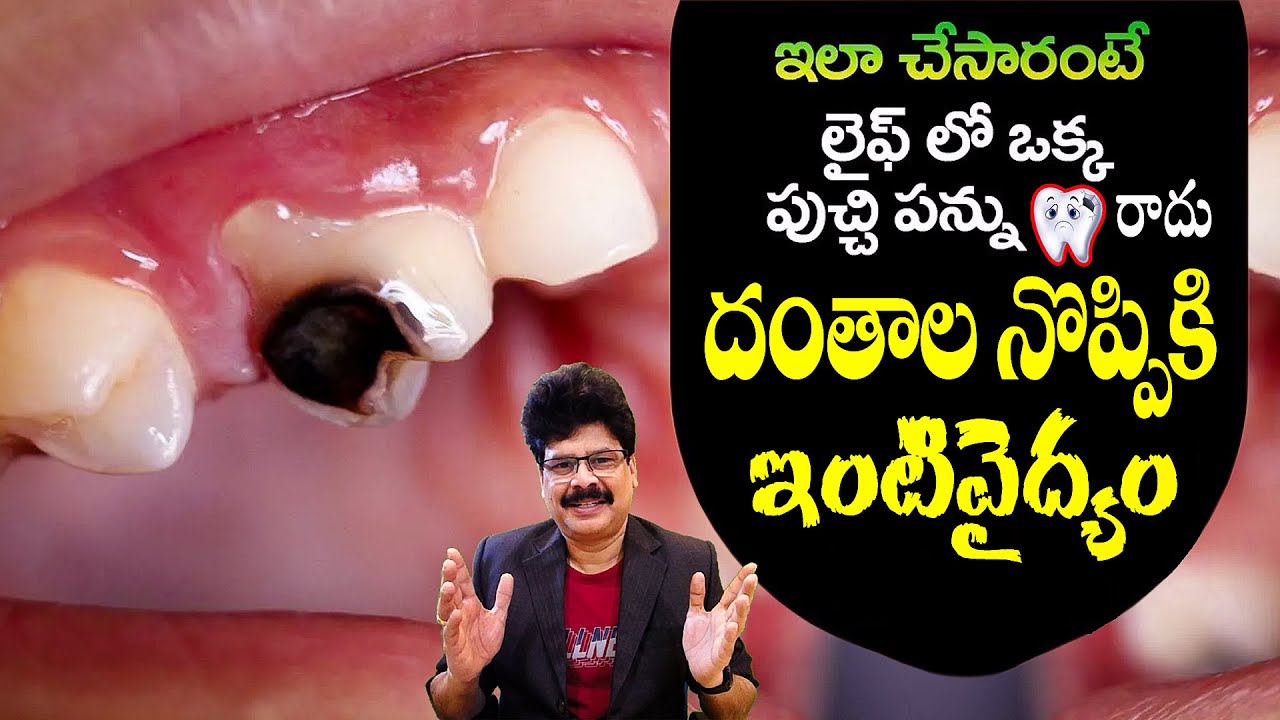 Tooth Decay, Cavity & Whitening: పళ్ళ ఆరోగ్యానికి పూర్తి గైడ్ | Dental Tips in Telugu