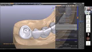 ZOOM- B4D Crown Module... Implants, Implants