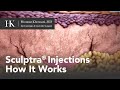 Sculptra injections for collagen growth  how it works  offered by dr hooman khorasani