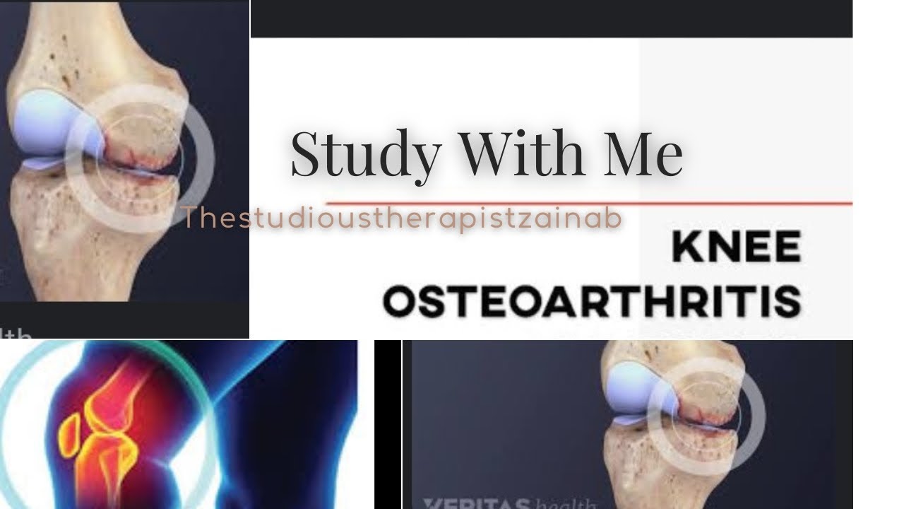 Knee osteoarthritis intro/etiology/symptoms etc. YouTube