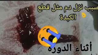 ما? سبب نزول كتل❌ من الدم اثناء الدوره الشهريه ?