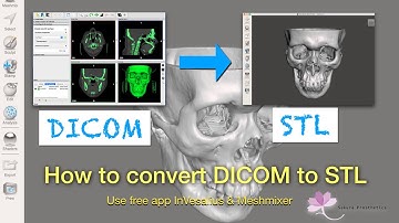 How to convert DICOM file to 3D printable STL file