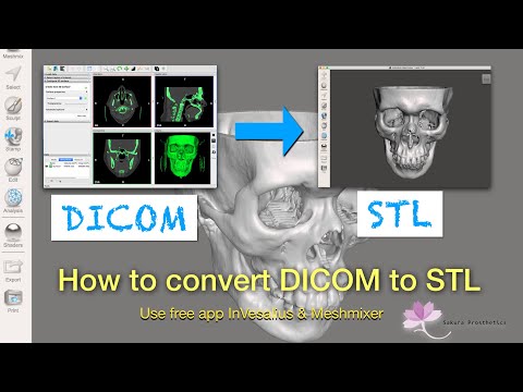 How to convert DICOM file to 3D printable STL file