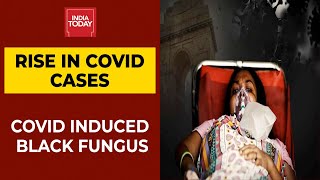 Black Fungus Detected In Covid-19 Survivors, Patients With Weak Immunity At Higher Risk