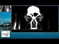 KSOS 2025   IC90   Integrated approach to Neuro Radiology in Ophthalmology from interpretation to in