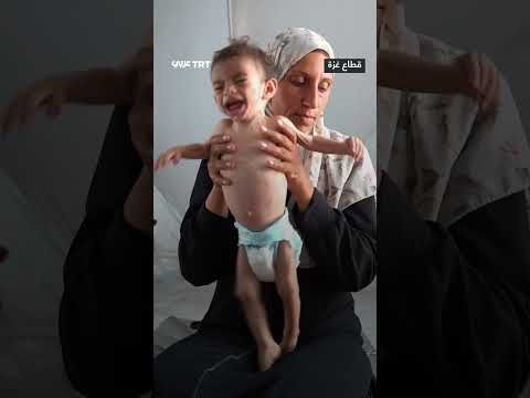 محتوى صوتي ومرئي قصير - Trt Arabic