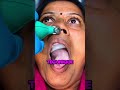 Why Doctors Inflate Balloons In Your Nose! 🤯🧑⚕️