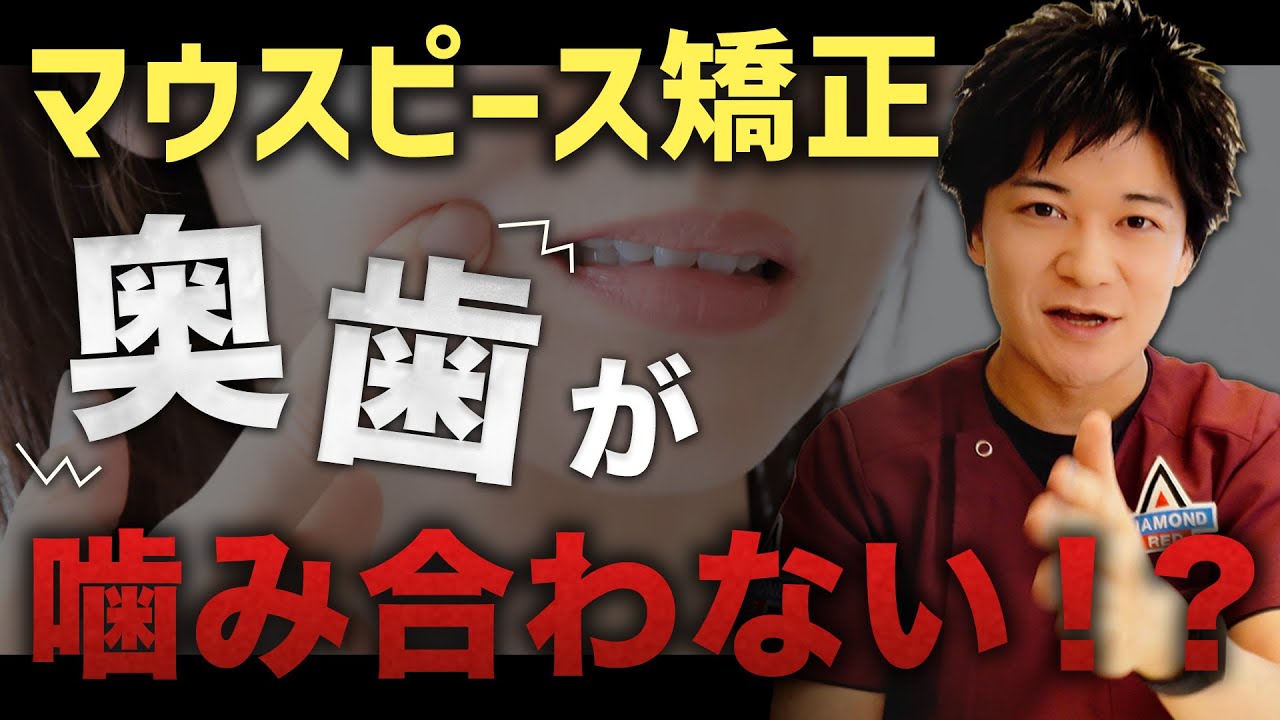 マウスピース矯正すると奥歯が噛み合わないって本当！？【歯列矯正】