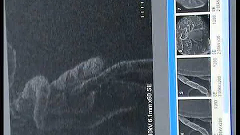 Living tick filmed under an electron microscope