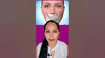 ¿Quién tiene una simetría facial perfecta?