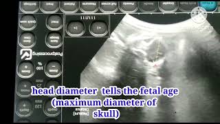 cat fetal  age  calculation by ultrasound      and heart beat calculations  stressed fetus or not