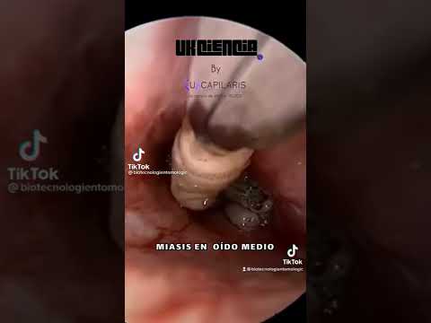 belatung-viral
