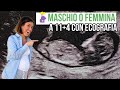 SCOPRIRE IL SESSO DEL BAMBINO A 12 SETTIMANE CON ECOGRAFIA: nub theory #gravidanza #incinta