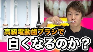 【検証】高級電動歯ブラシを使うと歯は白くなるのかな？