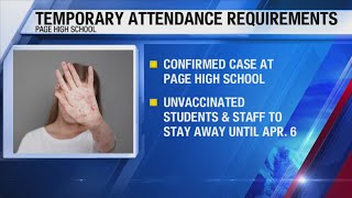 Following measles exposure, Page School District requires proof of vaccination for students to atten