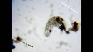 Tardígrado Y Rotífero