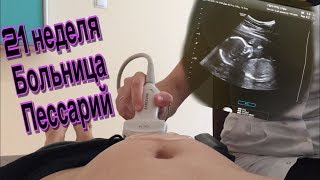 VLOG: 21 НЕДЕЛЯ I 2-й СКР I БОЛЬНИЦА I ПЕССАРИЙ VLOG: 21 НЕДЕЛЯ I 2-й СКР I БОЛЬНИЦА I ПЕССАРИЙ