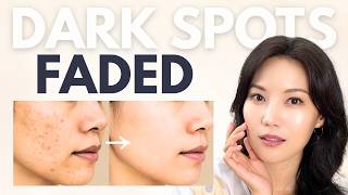 Melasma & Dark Spots on Face? The #1 Hyperpigmentation Treatment Mistake to Avoid (And What Works)