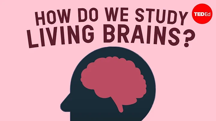 How do brain scans work? - John Borghi and Elizabe...