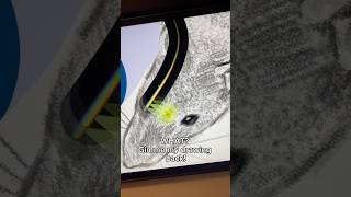 They Ruined My Drawing