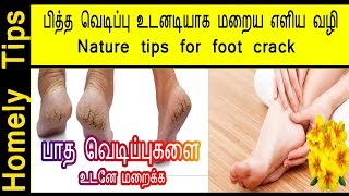 பித்த வெடிப்பு உடனடியாக மறைய எளிய வழிhow to cure cracked feet in tamil cracked heels foot crack