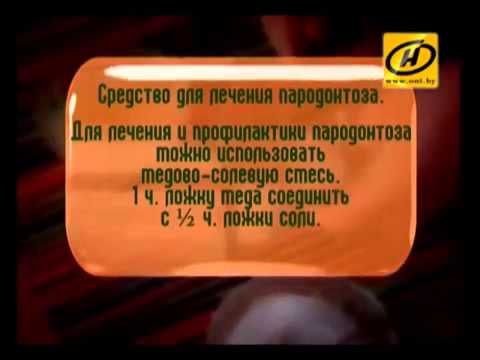 Пародонтоз Причины, лечение пародонтоза народными средствами и методами