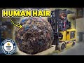 Largest Human Hair Ball - Guinness World Records