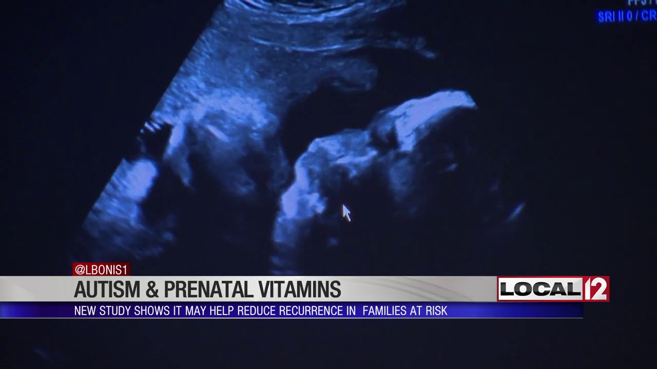 Study Taking prenatal vitamins during pregnancy could reduce