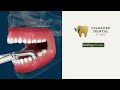 What Happens If You Don’t Replace Missing Teeth?