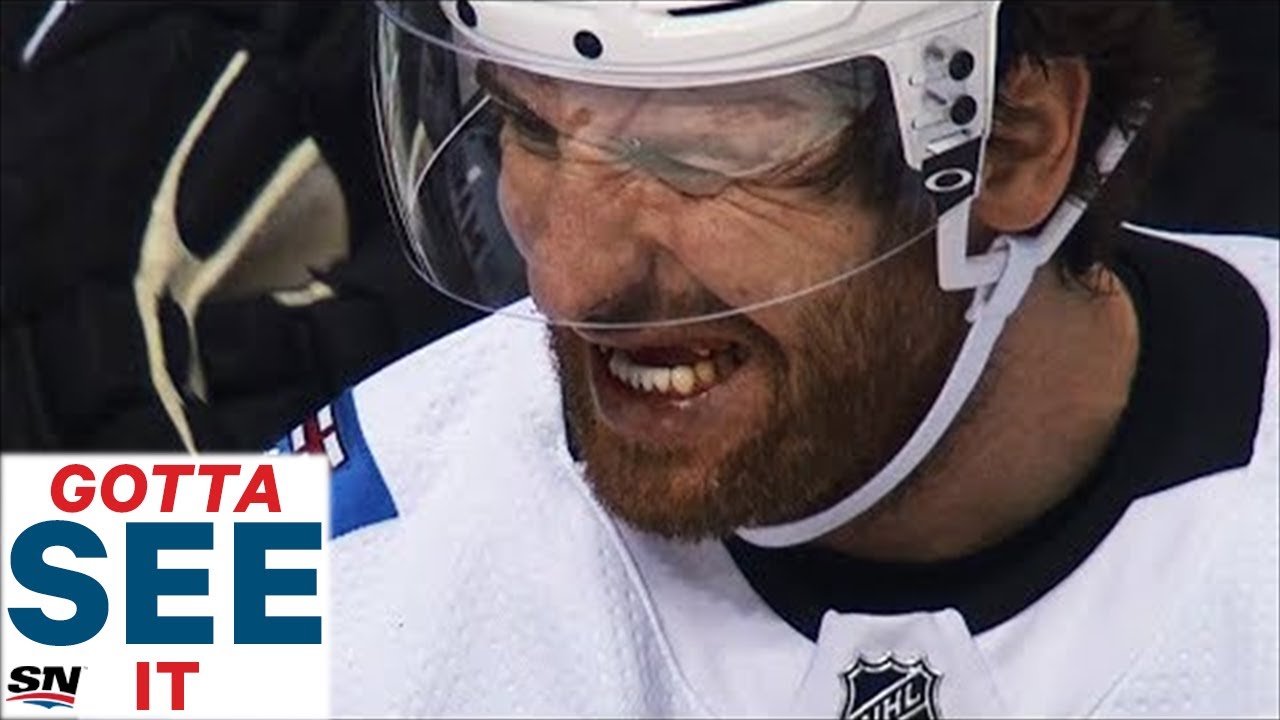 nhl teeth knocked out