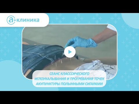 Иглоукалывание в самом