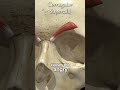 Corrugator supercilii muscle overview