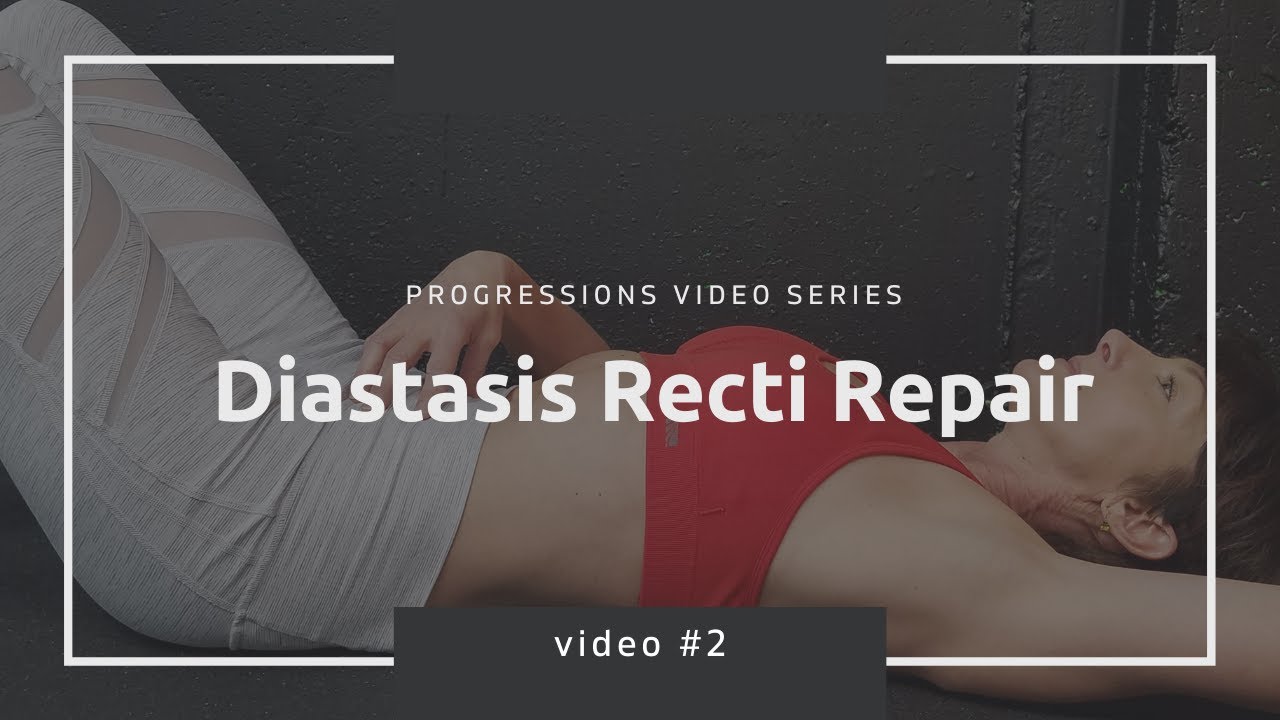 Diastasis Recti Exercises Video 2 YouTube