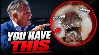 Exposing the Truth About Mercury Fillings (And What Your Dentist Won’t Tell You) News