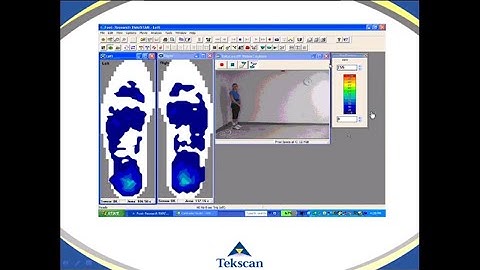 How to Choose & Implement Calibration Webinar