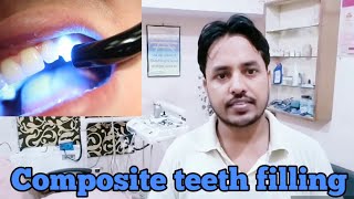 composite teeth filling Kya hai | teeth cavity filling procedure