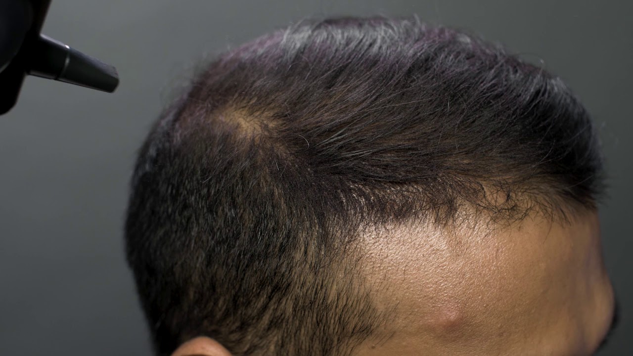 How To Apply SureThik Hair Fibers YouTube