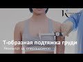 Т-образная ПОДТЯЖКА ГРУДИ - пластический хирург Владимир Косинец