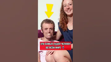 ЭТО САМЫЙ ХУДОЙ ЧЕЛОВЕК ВО ВСЁМ МИРЕ😱🏃