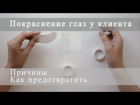 Покраснение глаз после наращивания ресниц