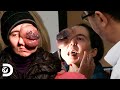 Mulher luta contra um tumor mortal no olho | Meu Corpo, Meu Desafio | Discovery Brasil