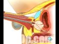 TURP Transurethral Resection Prostate via Penis Surgery