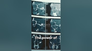 60 Seconds to Health: AI-Powered Early Disease Detection! #ai #innovation #healthcare #shorts