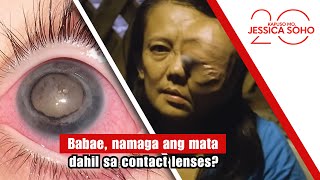 Download Lagu Babae, namaga ang mata dahil sa contact lenses? | Kapuso Mo, Jessica Soho MP3 Download Lagu Babae, namaga ang mata dahil sa contact lenses? | Kapuso Mo, Jessica Soho MP3