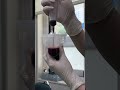 @DreamHairline #Stemcell#hairtreatment #hairrestoration #growthfactor #hairtransplantseoul