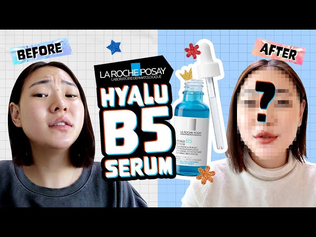 Honest Review] 14 days WITH LA ROCHE-POSAY Hyalu B5 Hyaluronic Acid Serum 