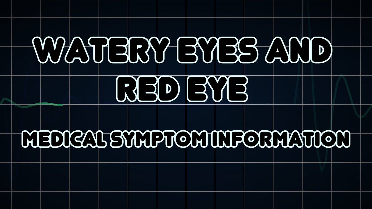 Watery Eyes And Red Eye Medical Symptom YouTube watery-eyes-and-red-eye-medical-symptom-youtube