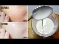 Add just 1 thing with rice flour cream and get full fairness  instant skin whitening face pack