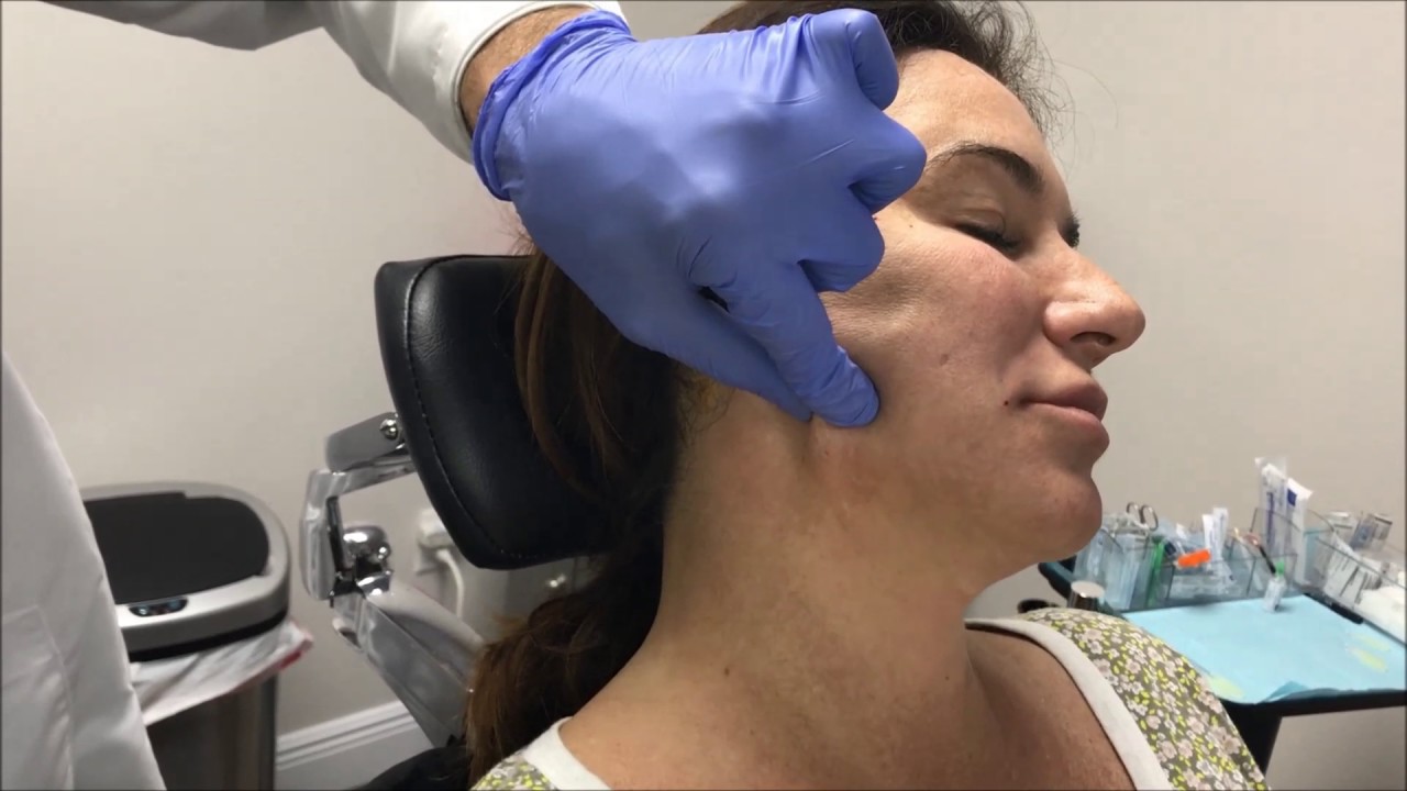 Neck Rejuvenation with PDO Threads YouTube